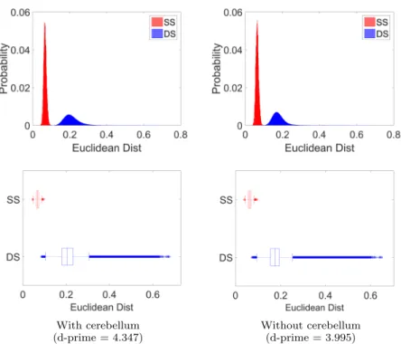 Figure 10: Impact of cerebellum exclusion on subject fingerprint. Probability normalized histogram (top) and box plot (bottom) for Euclidean distances between same subject (SS) and diﬀerent subject (DS) instances for all 851 subjects