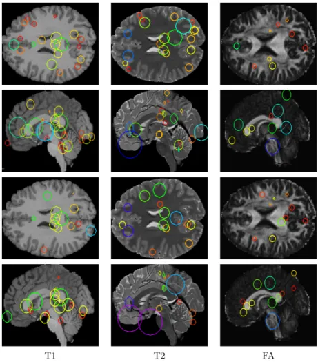 Figure 4: Example of feature correspondences for a subject and his/her MZ twin (rows 1-2), and the subject’s full sibling (FS) (rows 3-4)
