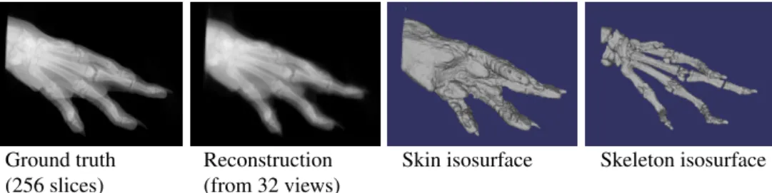 Figure 1: Rat paw volumetric reconstruction from a sparse set of simulated visible and x- x-ray images (32 frames from a rotational motion)