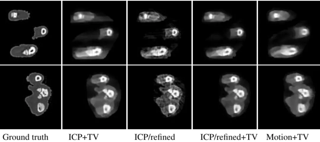 Figure 4: Human hand reconstruction with a combined visible &amp; x-ray system (32 frames).