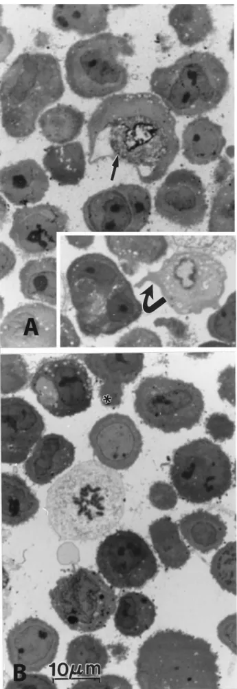 Fig. 4. A and B. LM views of human endometrioid carcinoma (MDAH 2774), 1- m m thick epoxy section stained by toluidine blue, 2-h after Sham-treatment