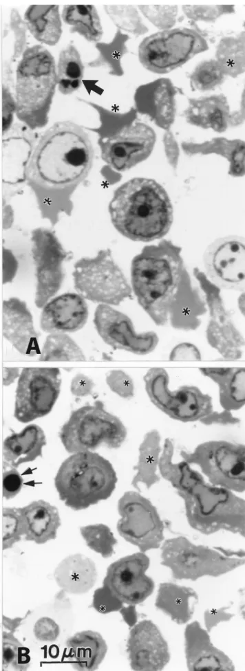 Fig. 5. A and B. LM views of human endometrioid carcinoma (MDAH 2774), 1- m m thick epoxy section stained by toluidine blue, 2-h after VC: VK 3 treatment
