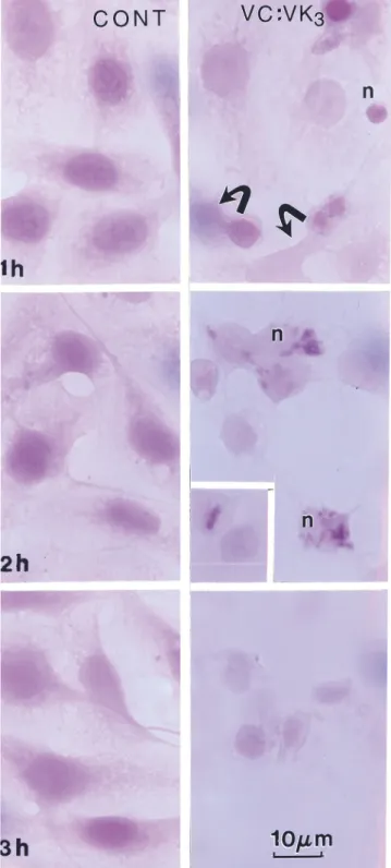 Fig. 7. Agarose gel electrophoresis of total DNA from Sham-treated and VC: VK3 treated human ﬁbroblasts (MHRF) and ovarian endometroid (MDAH 2774) cells