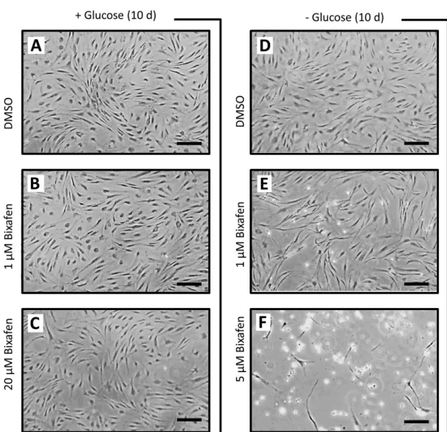 Fig 3. Masked by glucose, the consequences of SDH inhibition by SDHIs in human cells in culture