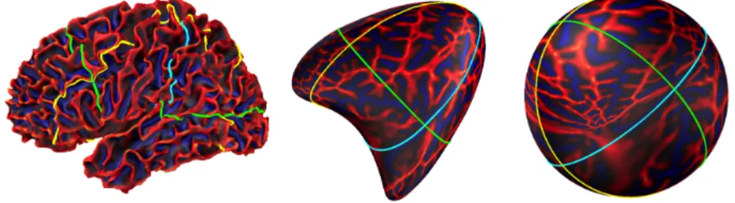 Fig 4 left showed an example of such faces and we observed that they correspond to local defects in the mesh, probably affecting a proper approximation of  eigen-functions.