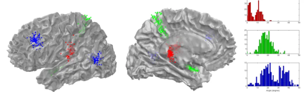 Fig. 3: Left and middle: The 6 intersection points of the 3 first nodal sets for all the meshes superimposed in the Talairach space