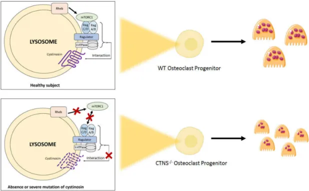 Figure 2. Hypothetical regulation of mtorc1 activation in osteoclasts derived from healthy donors and from patients with nephropathic cystinosis