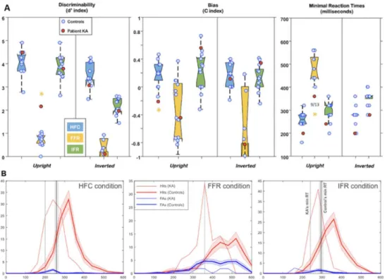Figure 5. (A) Patient KA’s performances during experiments 1 (Human Face Categorization [HFC], blue  boxplots), 2 (Famous Faces Recognition [FFR], yellow boxplots), and 3 (Individual Faces Recognition [IFR],  green boxplots)