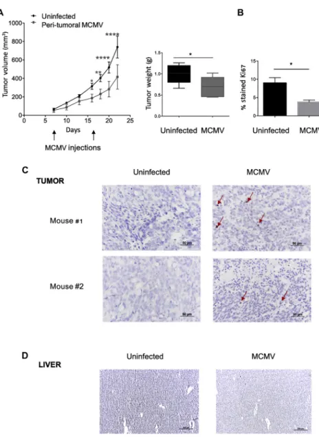 Figure 8. Inhibition of Human Cancer Cell Growth by Local MCMV Therapy