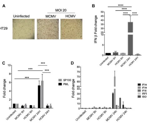 Figure 5. Increased Host Defense Mechanisms in MCMV- versus HCMV-Infected HT29 Cells (A) HT29 cells were left uninfected or subjected to MCMV or HCMV infection (MOI = 20); staining of murine (MCMV) and human (HCMV) IE-1 proteins was performed after 48 h