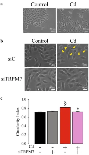 Fig. 4    TRPM7 regulates epithelial-to-mesenchymal transition  induced by cadmium exposure in MCF10A cells