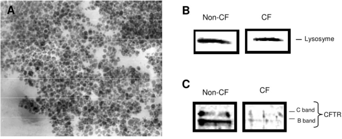 Figure 6                Non-CF  CF  B band C band  CFTR Lysosyme Non-CF CF B C A 