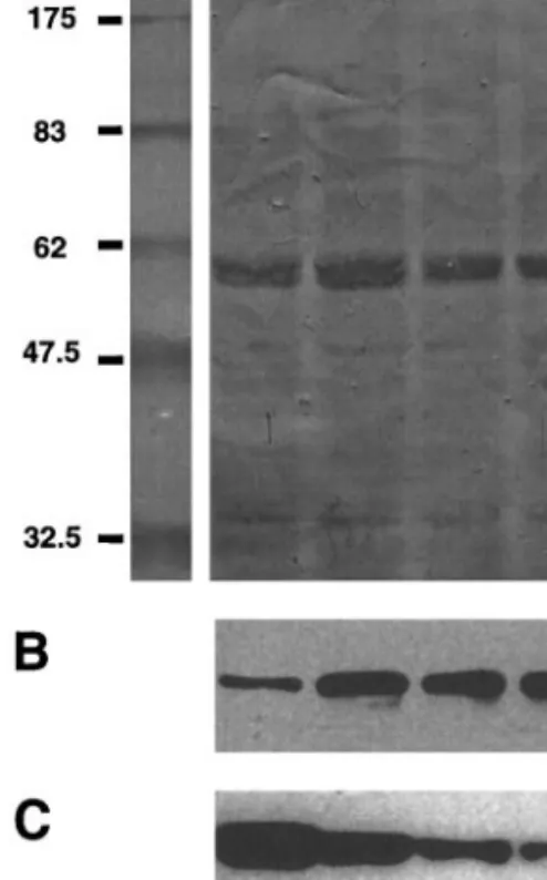 FIG. 5. Western blot analysis of involucrin and K10 protein expression in confluent autocrine keratinocyte cultures treated with RA