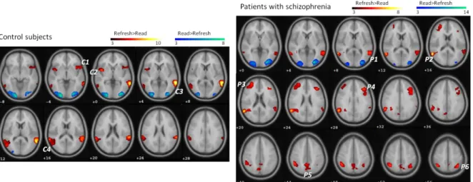 Fig. 2:  Significant activations (in yellow-red) and deactivations (in green-blue) during refreshing in 