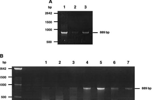 FIG. 2. RT-PCR analysis of the PRL receptor expression. (A) RT-PCR was performed on 0.1 m g of poly(A)RNA from human breast cancer MDA-453 cells (lane 1) or on 1 m g of total RNA from normal superficial human skin (lane 2) or from normal human breast tissu