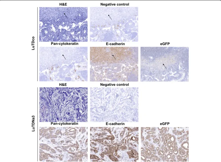 Fig. 8 Differentiated metastases in lymph nodes of athymic mice injected with Nanos3-expressing tumor-derived cell cultures