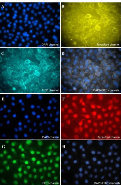 Figure 3. Microscopic images of cultures of (A–D) SK-BR-3 and (E–H) MDA- MDA-MB-231  immunostained  with  QD 569   conjugated  with  anti-HER2  sdAbs