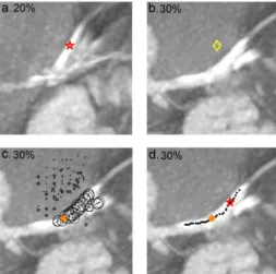 Fig. 4: Temporal  tracking of a voxel located on the circumflex artery  situated 1.5 cm away from the  left coronary artery origin