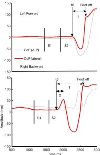 Figure 3. Event-related potentials in normal Anticipatory Postural Adjustments (APA) and APA error