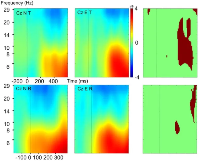 Figure 6. Event-related desynchronization/synchronization (ERD/ERS) in normal Anticipatory Postural  Adjustments (APA N) and APA error (E) over Cz