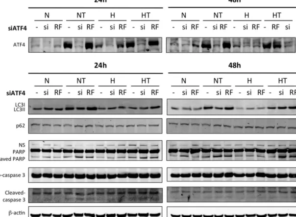 Fig. 7. ATF4 is involved in autophagy activation after taxol exposure in T47D cells. T47D cells were untransfected (−) or transfected with ATF4 siRNA (si) or negative control Risc Free siRNA (RF) at 50 nM for 24 h