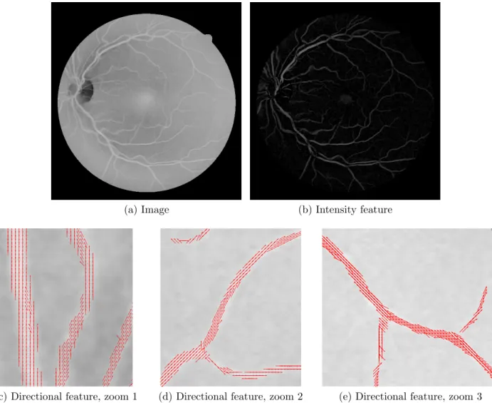 Figure 8: A retinal image (a), its intensity (b) and directional (c–e) features from RORPO, with parameters L min = 25, f actor = 1.5, nbScales = 2, R = 1