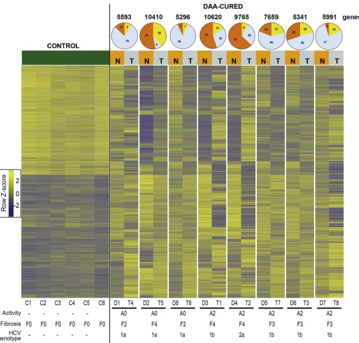 Figure 3. Pathway analysis of epigenetic and transcriptional reprogramming in HCV-infected patients unravels candidate genes driving carcinogenesis after DAA cure
