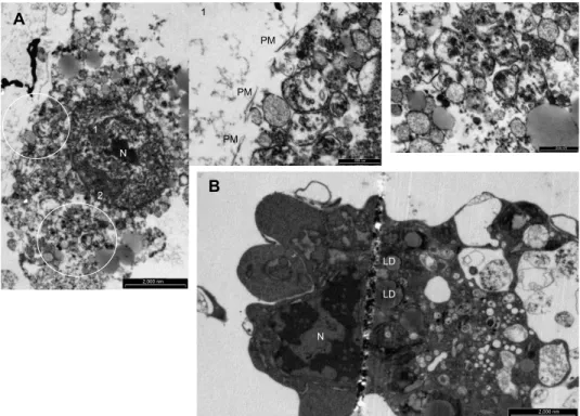 Figure 7 Effects of oxidized low-density lipoproteins on cell morphology under normoxia.
