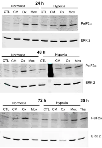 Figure S1 effects of hypoxia and low-density lipoproteins on the unfolded protein  response.