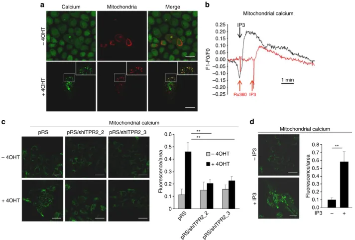 Figure 4 | Oncogenic stress induces mitochondrial calcium uptake during OIS. (a) HEC–TM cells were seeded at the same density, treated or not with 4OHT, transduced to express an RFP-coupled mitochondrial protein and a day later labelled by the calcium prob