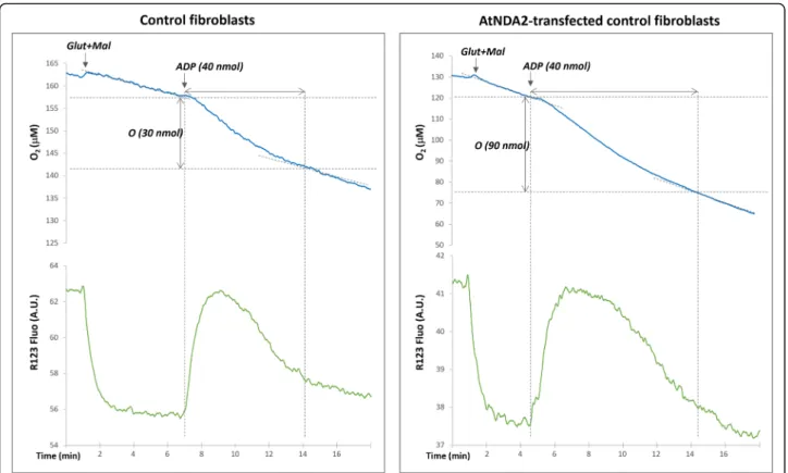 Fig. 4 Evaluation of mitochondrial respiration: Mitochondrial membrane potential variations assessed by rhodamine 123 fluorescence and oxygen uptake measured with optode device in digitonine permeabilized fibroblasts (representative graphs for the control 
