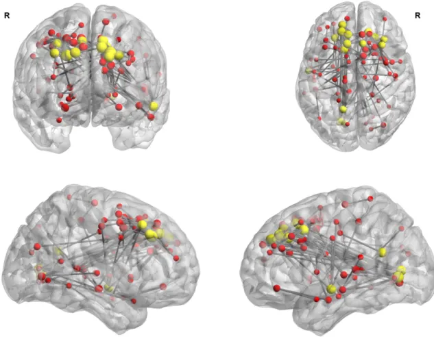 Fig. 2. Network based statistics (NBS) on absolute functional connectivity (t-test rTLE N controls, subnetwork of modiﬁed edges threshold T N = 5, p (NBS corrected) b 0.05)