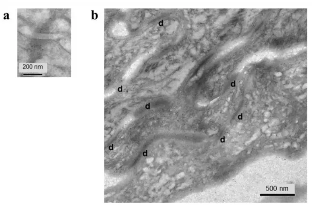 Figure  S4.  Transmembrane  protein  45A  localization  in  epidermis.  Post-embedding  immuno-electron  microscopy  of  normal  human  epidermis  using  Lowicryl  K4M  resin  and  5  nm  immunogold-labeled  secondary  antibody
