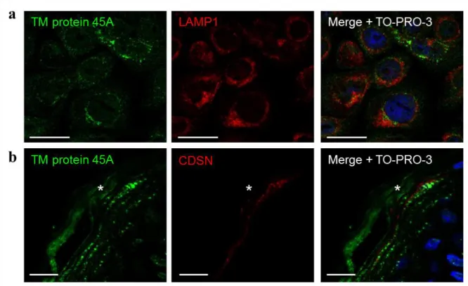 Figure S5. Co-detections of TM protein 45A with LAMP1 in vitro and with CDSN in the  granular layer of epidermis