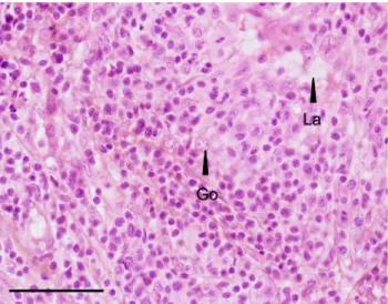 Figure 2. Altered testicular morphology. All-male rainbow trout testis at 136 dpf exposed chronically to 1 mg/L EE2