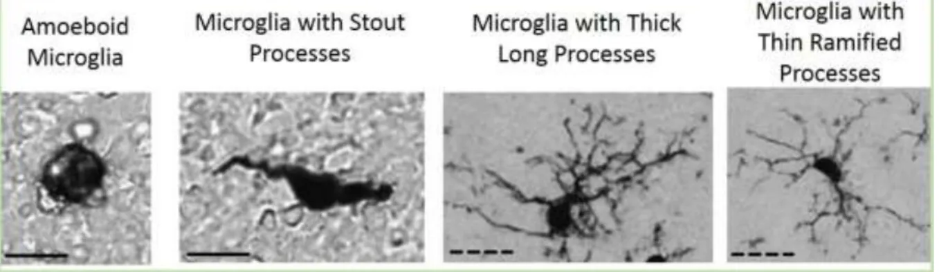 Figure  7:  Classification  of  microglial  morphology  found  in  adult  brain  in  normal  or  pathological conditions