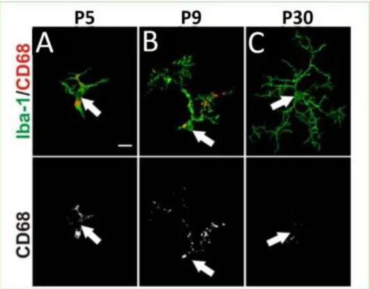 Figure  10:  Developmental  microglia  express  CD68  activation  marker.  Green:  microglia  stain  (Iba1); lower panel: CD68 stain; upper panel: merge