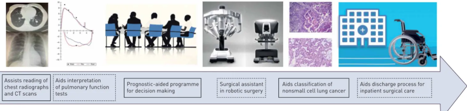 FIGURE 2 Potential applications of artificial intelligence in thoracic surgery in a clinical pathway