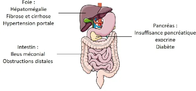 Figure 7 | Principales manifestations digestives chez le patient atteint de mucoviscidose