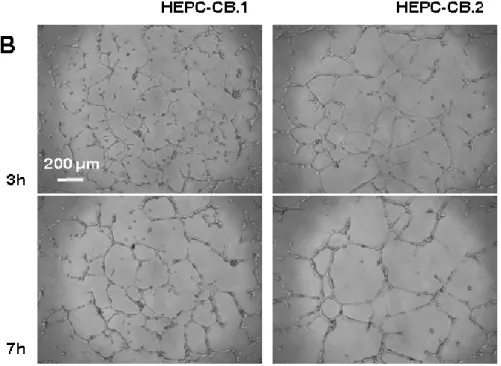 Figure 5.  Pseudovessels formation in Matrigel by HEPC-CB.1, HEPC-CB.2 and  HSkMEC cell lines 