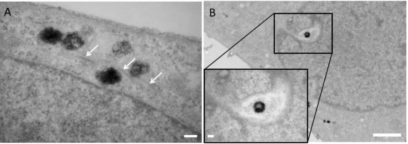 Figure 5. (A) Viral complexes in proximity to microtubules (white arrows) or (B) invaginated in the nuclear  envelope Scale bar is 200 nm in A and B insert , 2 µm in Bt