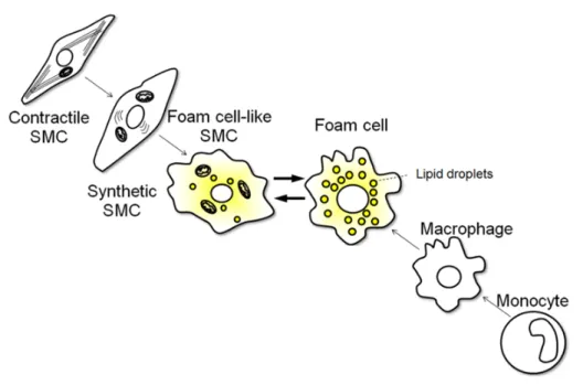 Figure 4.  Formation des cellules spumeuses issues de macrophages et de CML (SMC pour  Smooth Muscle Cells) (Aikawa 2015)