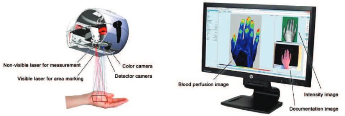 Figure 4: Imagerie de contraste utilisant la granularité laser.