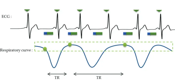 Figure 3.25: The navigator (blue) is played before the sequence (green), is the  information obtained with the navigator is outside the windows the sequence is not  played