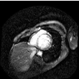 Figure 1.25 – Exemple d’acquisition IRM cardiaque