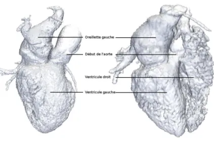 Figure 3.3 – Exemples de segmentations des bases MSCT. Les segmentations contiennent l’endocarde du VG, le début de l’aorte et l’oreillette gauche (à gauche)