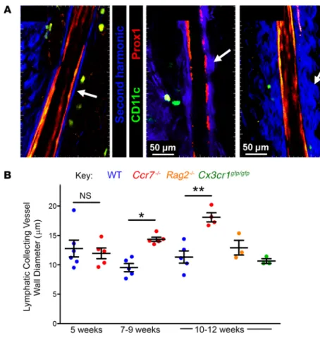 Figure 2. Increased adventitial wall thickness in lym- lym-phatic collecting vessels of Ccr7 –/–  mice