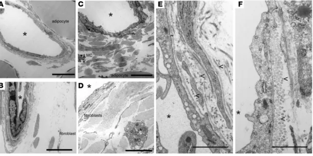 Figure 3. Electron micrographs of lymphatic collecting vessels within afferent s.c. adipose tissue near the brachial LNs from Ccr7 +/+  or Ccr7 –/–  mice