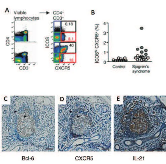Figure 12: Tfh-like cells in patients with SS. A, circulating and tonsillar Tfh  cells