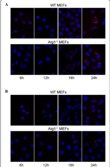 Figure 2 Fluorescence microscopy analysis of WT MEFs and Atg5 −/− MEFs infected with B